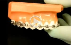 Emergency Care Brace Connection in Downey, CA