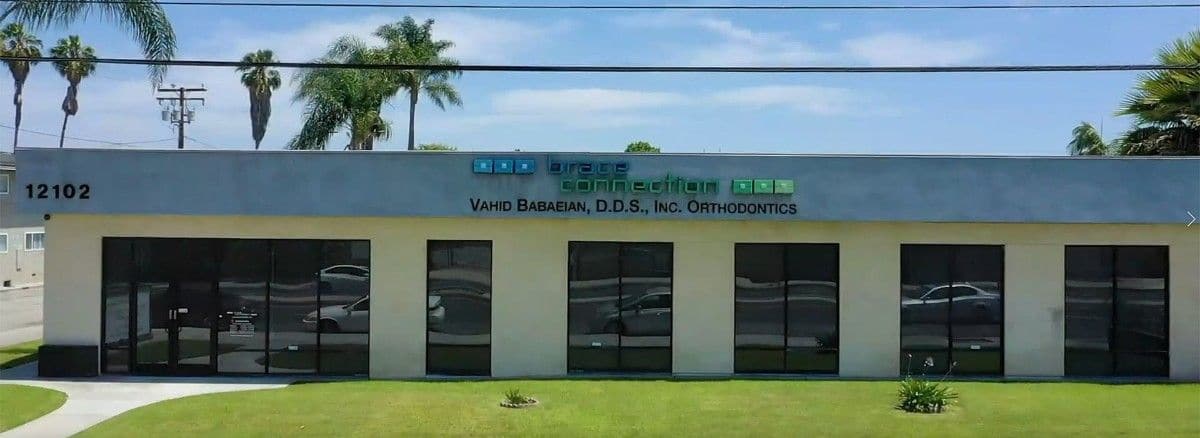 Office Building Brace Connection in Downey, CA